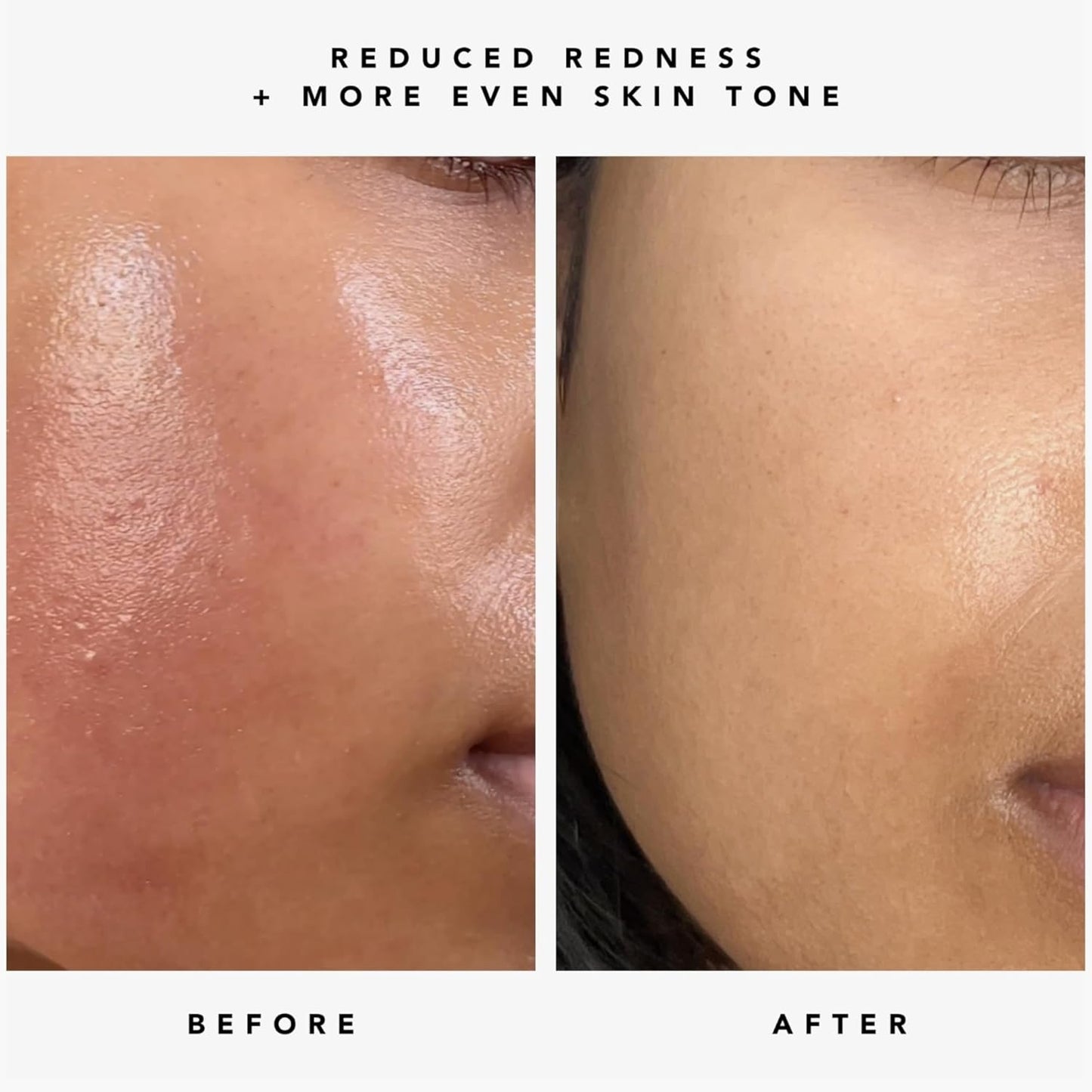 HERBIVORE Nova 15% Vitamin C + Turmeric Brightening Serum for Dark Spots, Hyperpigmentation + Even Skin Tone | Vegan, Plant-Based, Cruelty-Free, 30 mL / 1 oz