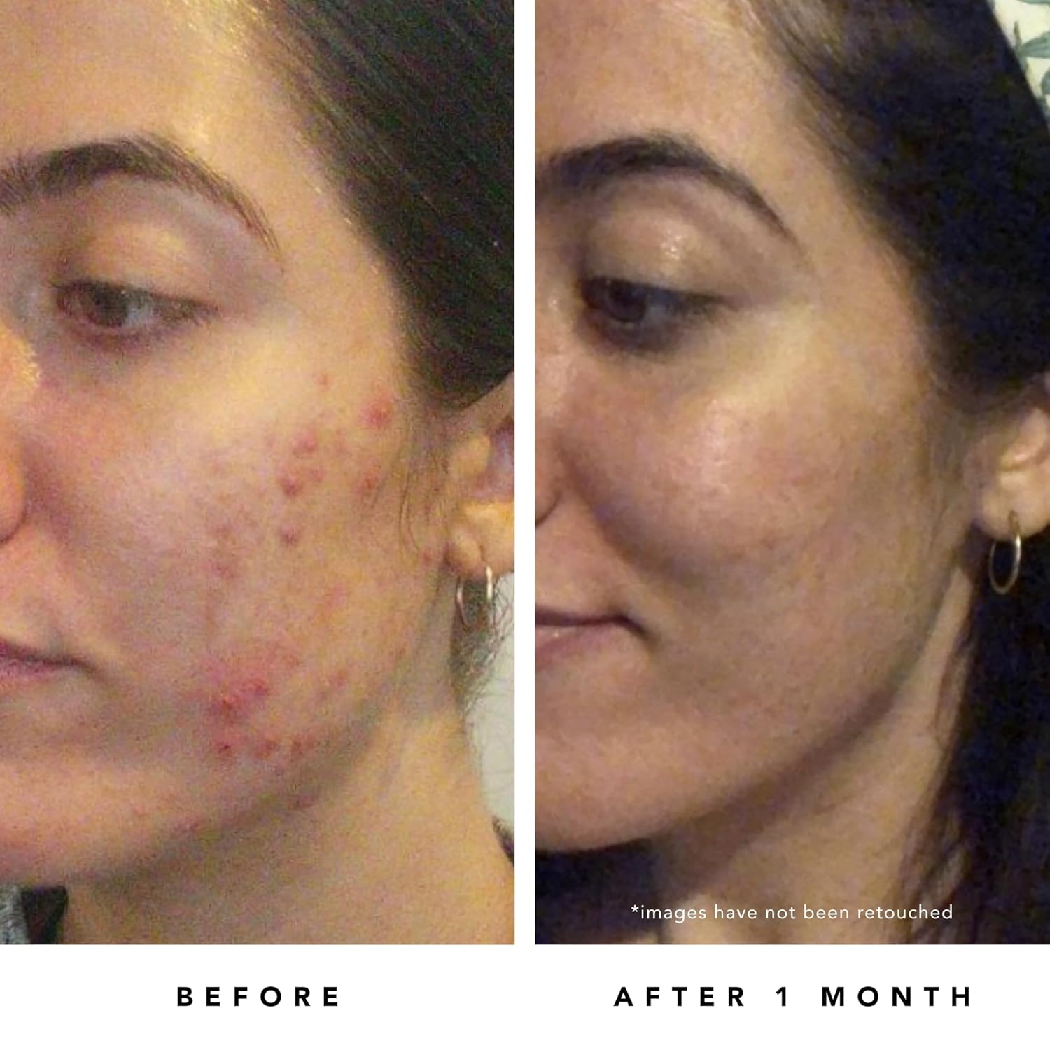 HERBIVORE Blue Tansy BHA & Enzyme Pore Refining Mask - Naturally Clarifies Acne, Blemishes & Redness, Vegan & Cruelty-Free, 60 mL / 2.02 oz